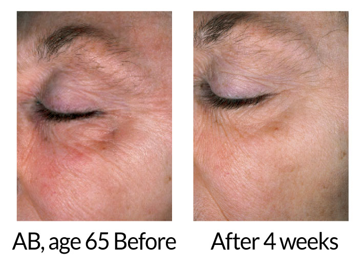 Toki™ Powder For porcelain skin from within– 180 gram jar - Image 2