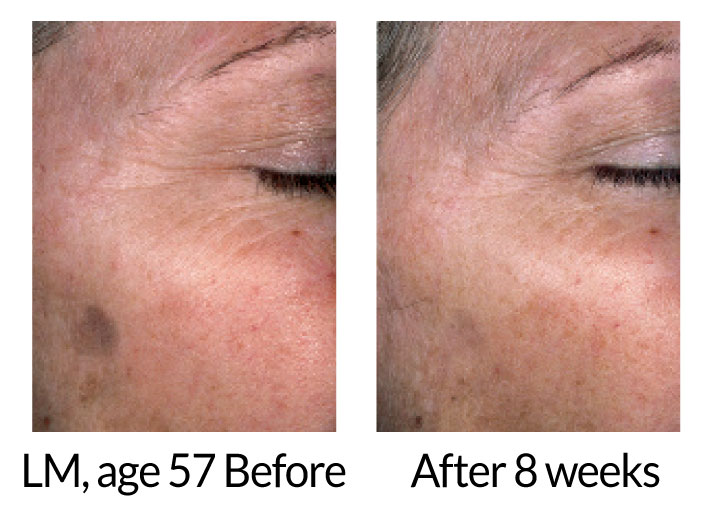 Toki™ Powder For porcelain skin from within– 180 gram jar - Image 3